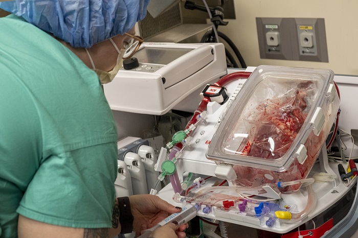 ‘Heart In A Box’ Transplant Is First Of Its Kind In Illinois ...